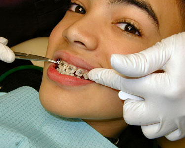 Kids Tallahassee: Orthodontists - Fun 4 Tally Kids